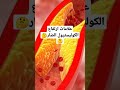 علامات ارتفاع الكوليسترول الضار |اعراض ارتفاع الكوليسترول