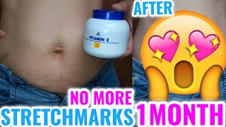 STRETCHMARKS NO MORE AR VITAMIN E CREAM AFTER 1 MONTH RESULT