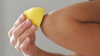 LIGHTEN DARK KNEES AND ELBOWS QUICK &amp; NATURALLY AT HOME 