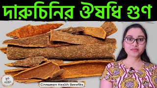 দারুচিনির উপকারিতা | দারুচিনি খেলে কি হয় | Dalchini Khele Ki Hoy | Daruchinir Upokarita | Daruchini