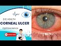 what is corneal ulcer?  Corneal ulcers |causes |Treatment |prevention