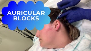 How to do an auricular block (nerve block if an earring is stuck)