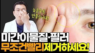 미간이물질, 필러 실명위험 높습니다! 이물질, 필러 미간시술 조심해야하는 이유!