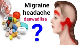 Daawada ugu fiican ee  madax xanuunka nooca migraine-ka lagu daaweeyo