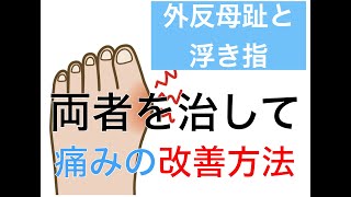 外反母趾と浮き指の関係性。両者を治して痛みを変形を改善｜足の悩み解消専門チャンネル