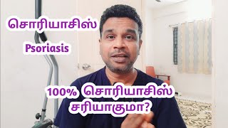 சொரியாசிஸ் முழுவதுமாக சரியாகுமா? | Can psoriasis be cured completely | சொரியாசிஸ் |Psoriasis