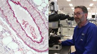 Microscope tutorial - Troubleshooting elastin stains - Part 2