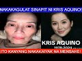 KRIS AQUINO LATEST UPDATE | ITO NAKAKALUNGKOT NA KANYANG SINAPIT!