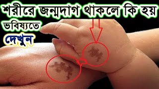 শরীরে জন্মদাগ থাকলে ভবিষ্যতে কি হবে আপনার জানেন জানতে চাইলে দেখুন !