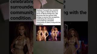 Winnie Harlow Makes HISTORY at Madame Tussauds (First Vitiligo Figure!)