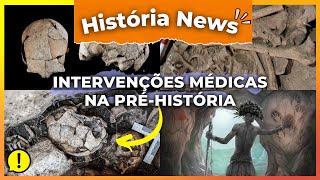 Descubra dois casos de intervenções médicas na Pré-história | HISTÓRIAS NEWS ⚠️