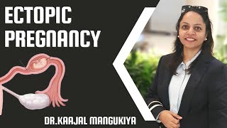 Ectopic Pregnancy | What Does it Mean by Ectopic | Dr.Kaajal Mangukiya
