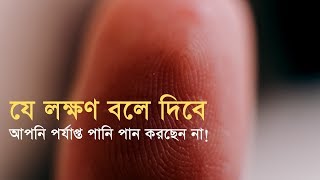 এই ৫ টি লক্ষণ-ই বলে দিবে আপনি পর্যাপ্ত পানি পান করছেন না!