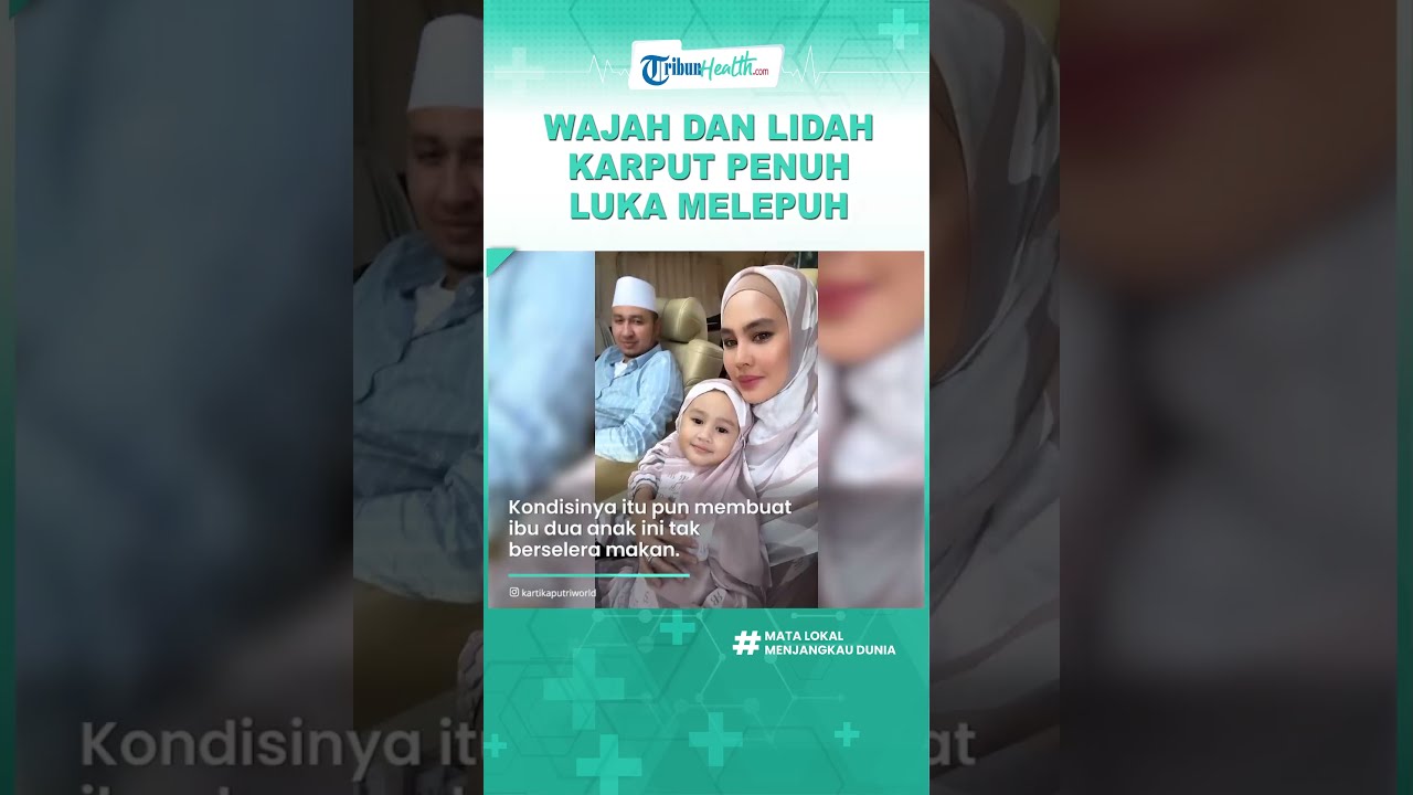 Wajah Dan Lidah Tiba-tiba Penuh Luka Hingga Melepuh, Kartika Putri ...