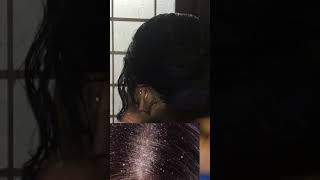 താരൻ പൂർണമായും മാറാൻ| 100% Dandruff Removal 👌👌👌