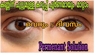 കണ്ണിന് ചുറ്റുമുള്ള കറുപ്പ് മാറ്റാം വെറും 5 ദിവസത്തിൽ|Remove darkcircles permenantly