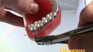 How to Use the Distal End Cutter Powerprox Six Month Braces Orthodontic Education Video