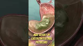 what causes night time nausea ?