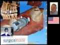 Fun with an IMMEDIATE implant and provisional (SurgicalMaster Instant Replay)