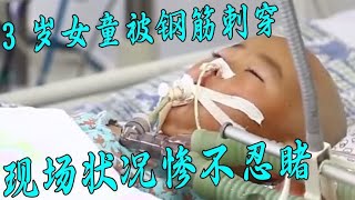 3岁女童被钢筋贯穿脑袋，现场画面惨不忍睹，医生：回家准备后事