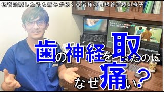 歯の神経を取ったのに、なぜ痛い？《根管治療後、なぜ痛い？その原因は？》破折器具（ファイル）を取り除く実際の様子