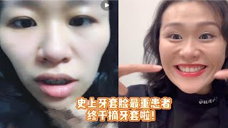 干货满满的【整牙经验分享】，历时两年从鬼变人。关于正畸的所有高频问题都在这儿