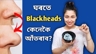 How To Get Rid Of Blackheads Naturally? | Assamese Skin Care Video