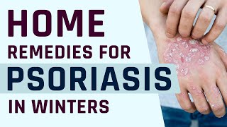 Best Home Remedies for Psoriasis in Winters | Dr. Megha Chaturvedi