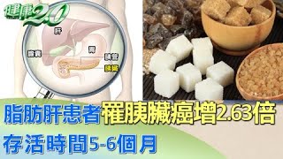 脂肪肝患者罹胰臟癌增2.63倍 存活時間5-6個月 健康2.0