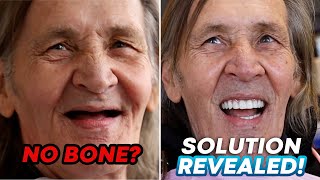 No Bone for Dental Implants? The Secret Procedure That Works!