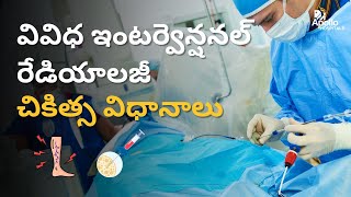 ఇంటర్వెన్షనల్ రేడియాలజీ చికిత్స విధానాలు | Interventional Radiology Latest Treatments | Dr Suresh