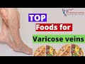 Top 6 Foods for Varicose veins | Varicose Diet | Foods that prevent Varicose veins