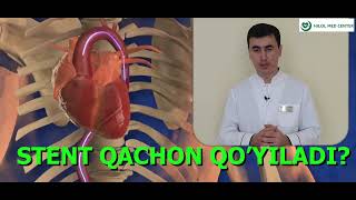 QACHON STENT QO'YILADI?/ ҚАЧОН СТЕНТ ҚЎЙИЛАДИ.