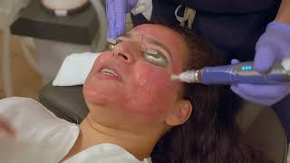 Skin rejuvenation combo treatment | Dr. Prem Tripathi