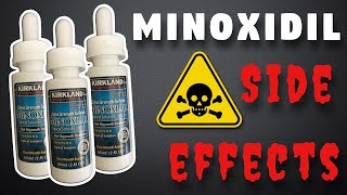 Minoxidil Side Effects - What To Expect