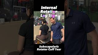 Internal Rotation Lag Sign | Subscapularis Rotator Cuff Tear Examination