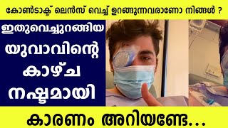 കോൺടാക്റ്റ് ലെൻസ് വച്ച്‌ ഉറങ്ങിയ 21 വയസ്സുകാരന് സംഭവിച്ചത്.. | Parasitic Infection | Eyesight Loss