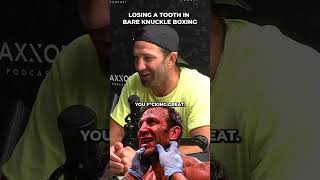 Luke Rockhold Lost a tooth bare knuckle boxing | FADE ON SITE