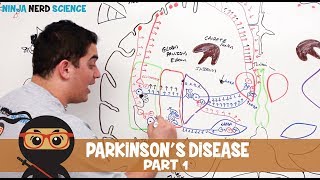 Parkinson's Disease | Clinical Presentation | Part 1