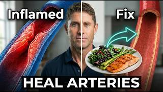 Unblock Arteries Fast Doctors Hate This