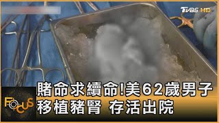 賭命求續命!美62歲男子移植豬腎 存活出院｜葉佳蓉｜FOCUS全球新聞 20240404@TVBSNEWS01