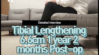 LON Tibial Lengthening (6.6cm) 1 year 2 months post-op