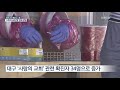 대구 하루 30명 신규 확진…4월 이후 최다 발생 kbs뉴스 news