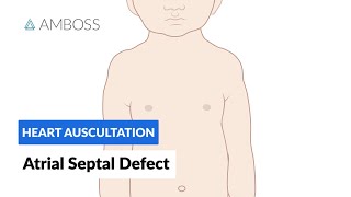 Atrial Septal Defect - Heart Auscultation - Episode 7