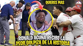 La vez que RONALD ACUÑA JR recibió la PEOR GOLPIZA de la HISTORIA | MLB