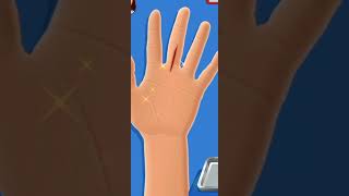 #hand #ortho हाथ हड्डी जोर #shortvideo #शॉर्टवीडियो