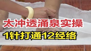 1针透两穴，太冲透涌泉应该怎么扎？中医实操教你打通12经络！舒卿针灸教学视频全集！