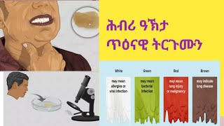 ሕብርታት ዓኽታን ጥዕናዊ ትርጉሙን Sputum color and it's medical indication