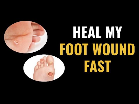 Heal My Foot Wound Fast Heal My Foot Wound Fast