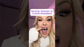 Veneers vs crowns #veneers